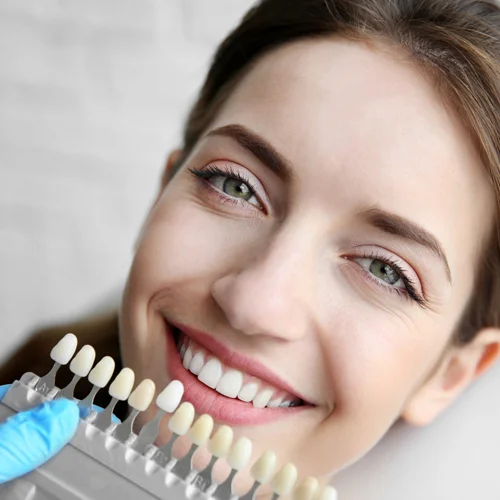 Smile-makeover-3
