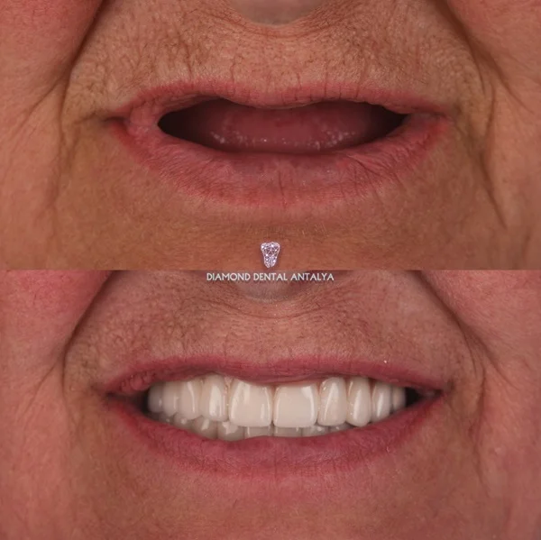 svitlanaSamsoniuk-2.webp