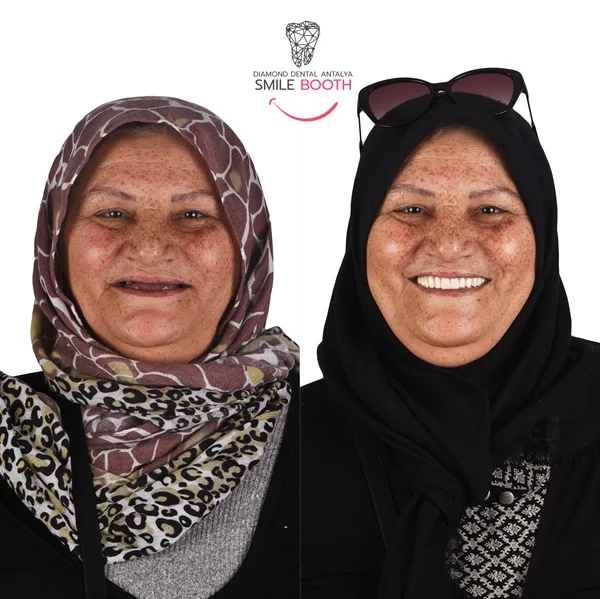 zeliha-1.webp